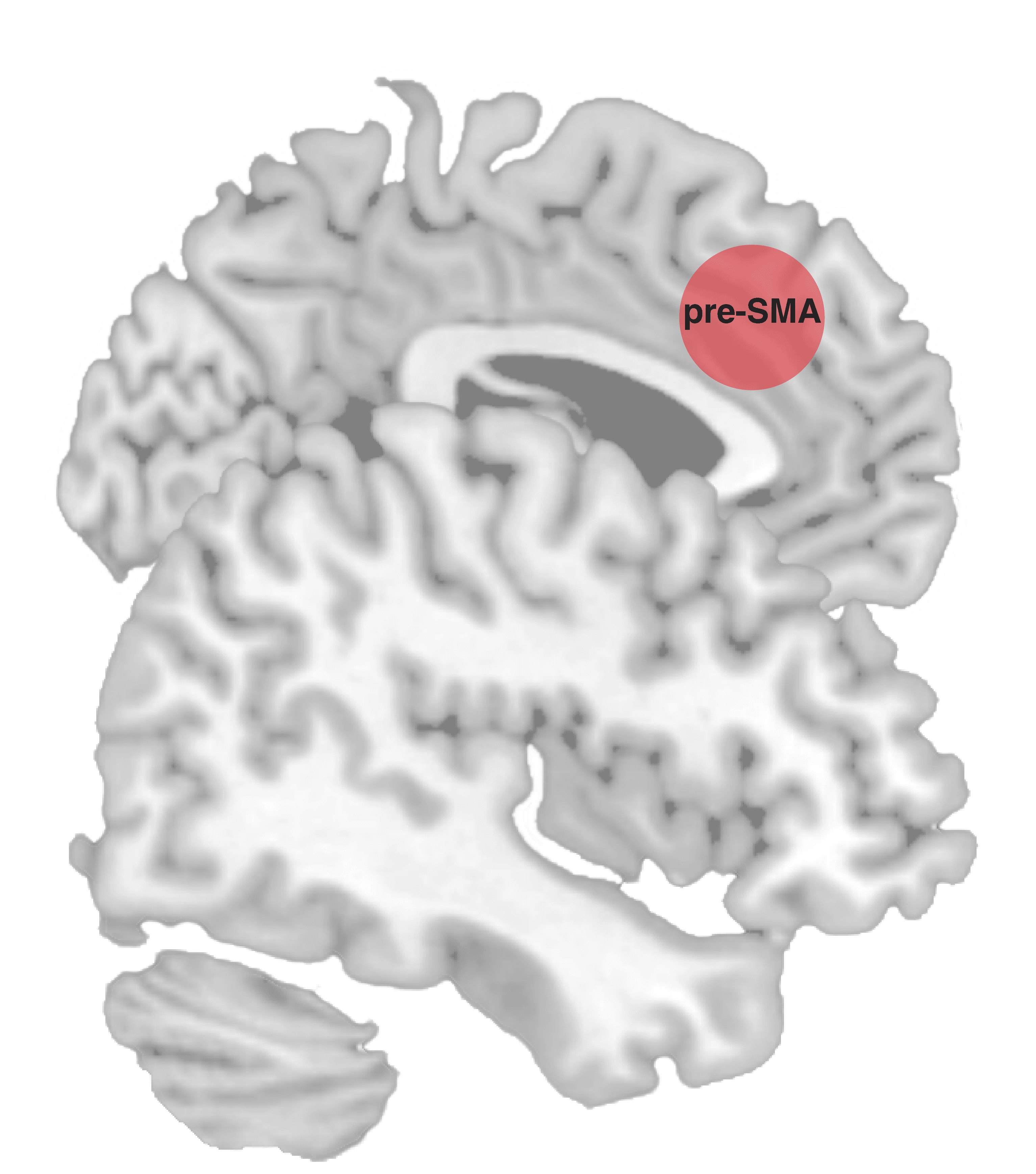 Brain image with the pre-supplementary motor area highlighted. Our recent work shows it exerts inhibitory control by adjusting the brain's thresholds for making a response.
